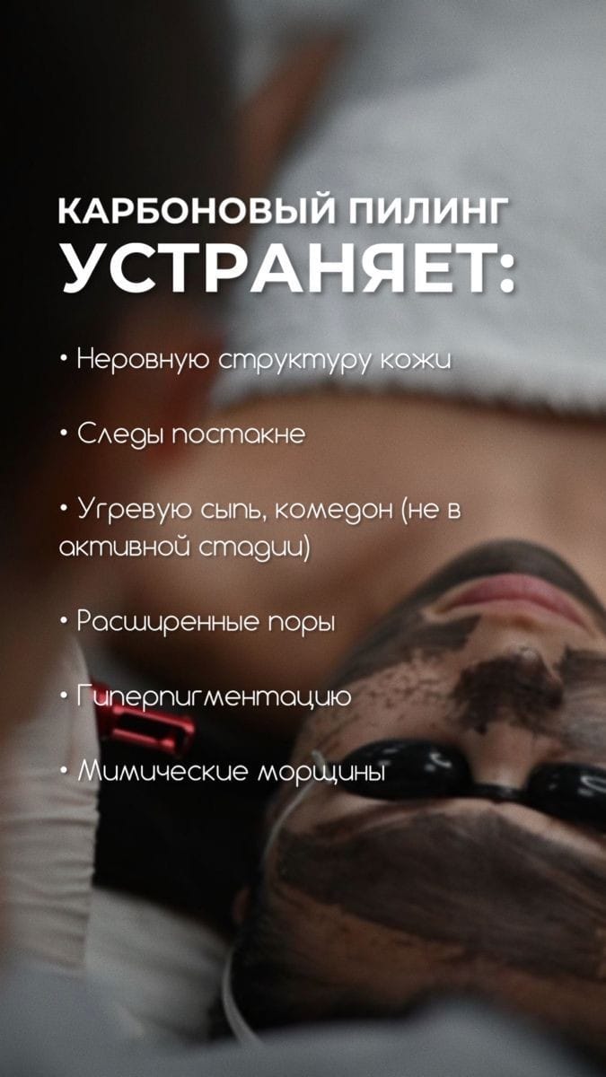 Карбоновый лазерный пилинг Карбоновый лазерный пилинг