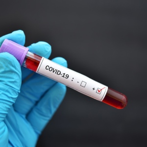 ПЦР-тест на COVID-19, мазок